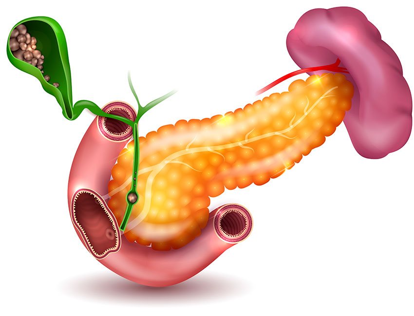 Chronic pancreatitis